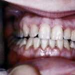 Pricing Strategies For Sellers In The Aftermarket Auto Parts Industry